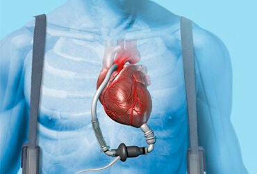 Revolutionizing Heart Failure Care: The Era of Smart Home Monitoring