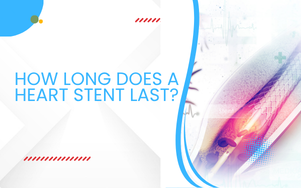 How Long Does a Heart Stent Last?