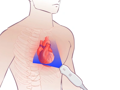 H2_ What is 2D Echo_Color_Tissue Doppler Cardiography
