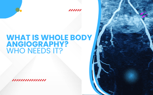 What Is Whole Body Angiography? Who Needs It?
