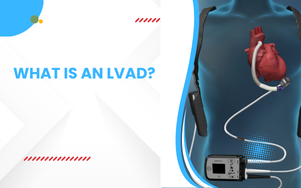 What Is an LVAD?