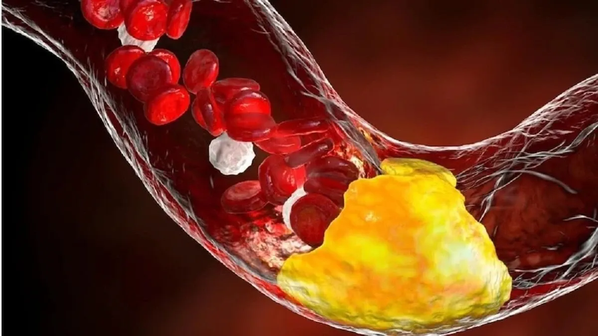 imgi_60_cholesterol-23552739-16x9 - AHF Clinic