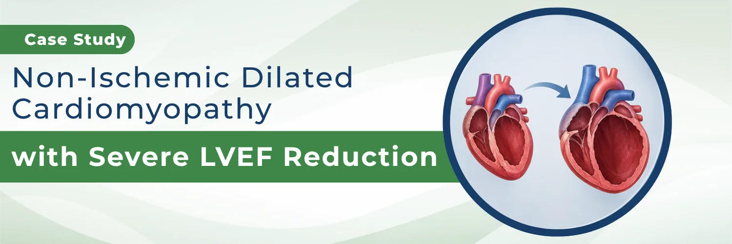 Non-Ischemic Dilated Cardiomyopathy with Severe LVEF Reduction - AHF Clinic